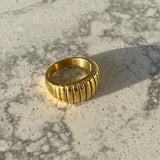 The Ana Ring.